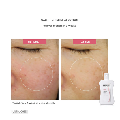 Physiogel Calming Relief A.I. Lotion For Dry Irritated And Reactive Skin 200ml