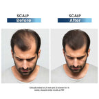 Rederm Aesthetics Tressfix Anti-Hairfall & Anti-Dandruff Shampoo 120ml