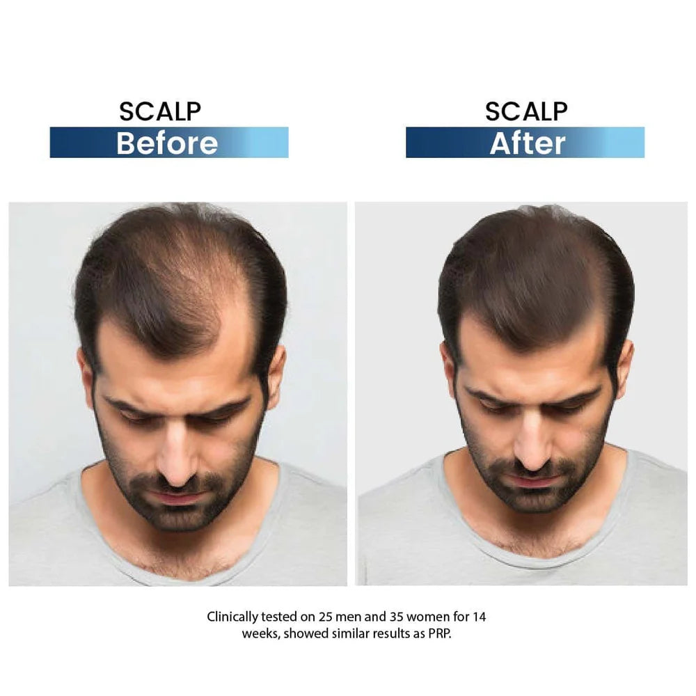 Rederm Aesthetics Tressfix Anti-Hairfall & Anti-Dandruff Shampoo 120ml