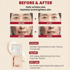 Seoul 1988 Retinal Liposome 1% + Fermented Rice Cream