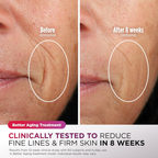 Shark CryoGlow LED Face Mask with Under-Eye Cooling, Anti-Ageing & Repair