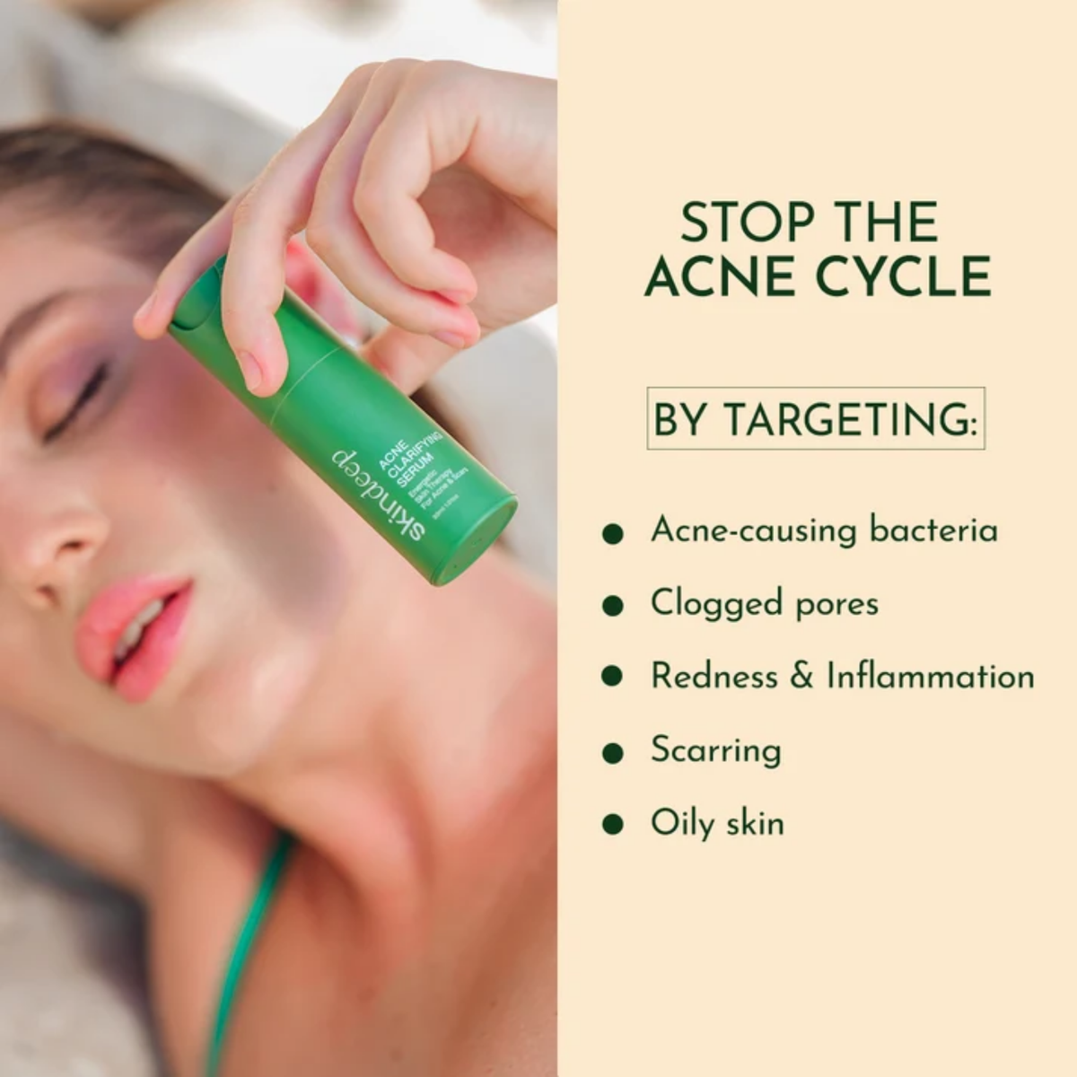 Skin Deep Acne Clarifying Serum