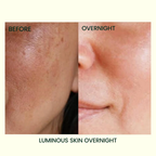 Skin Deep Bakuchiol Resurfacing Night Serum with 10% Lactic Acid