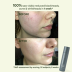 Skin Deep Clean Sweep  2% BHA Pore Minimizing Toner