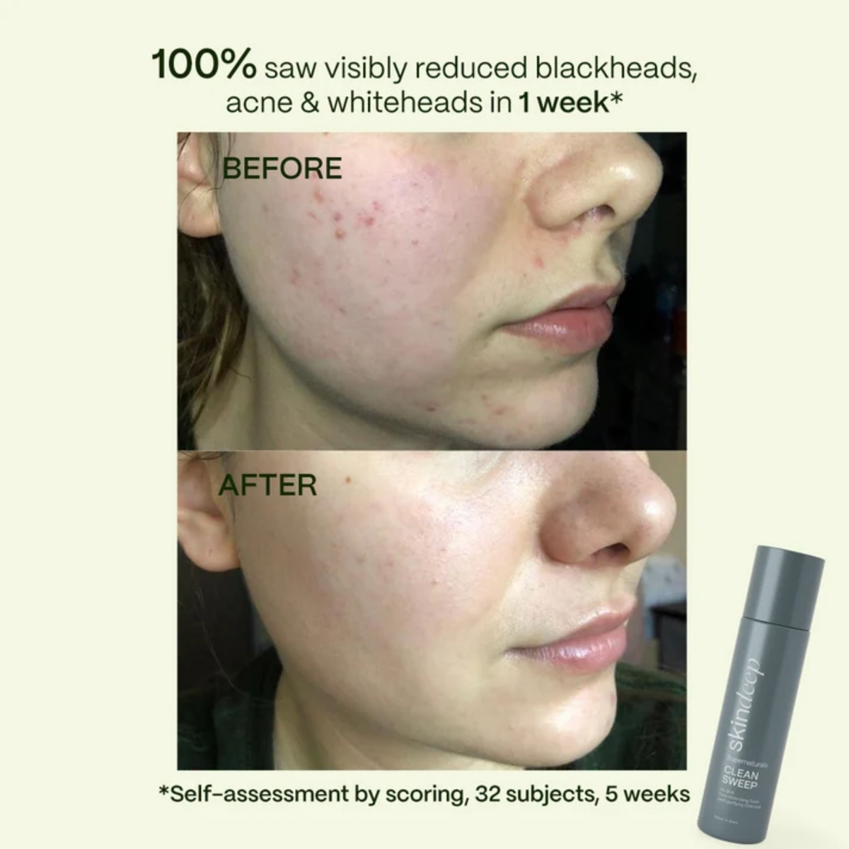 Skin Deep Clean Sweep  2% BHA Pore Minimizing Toner