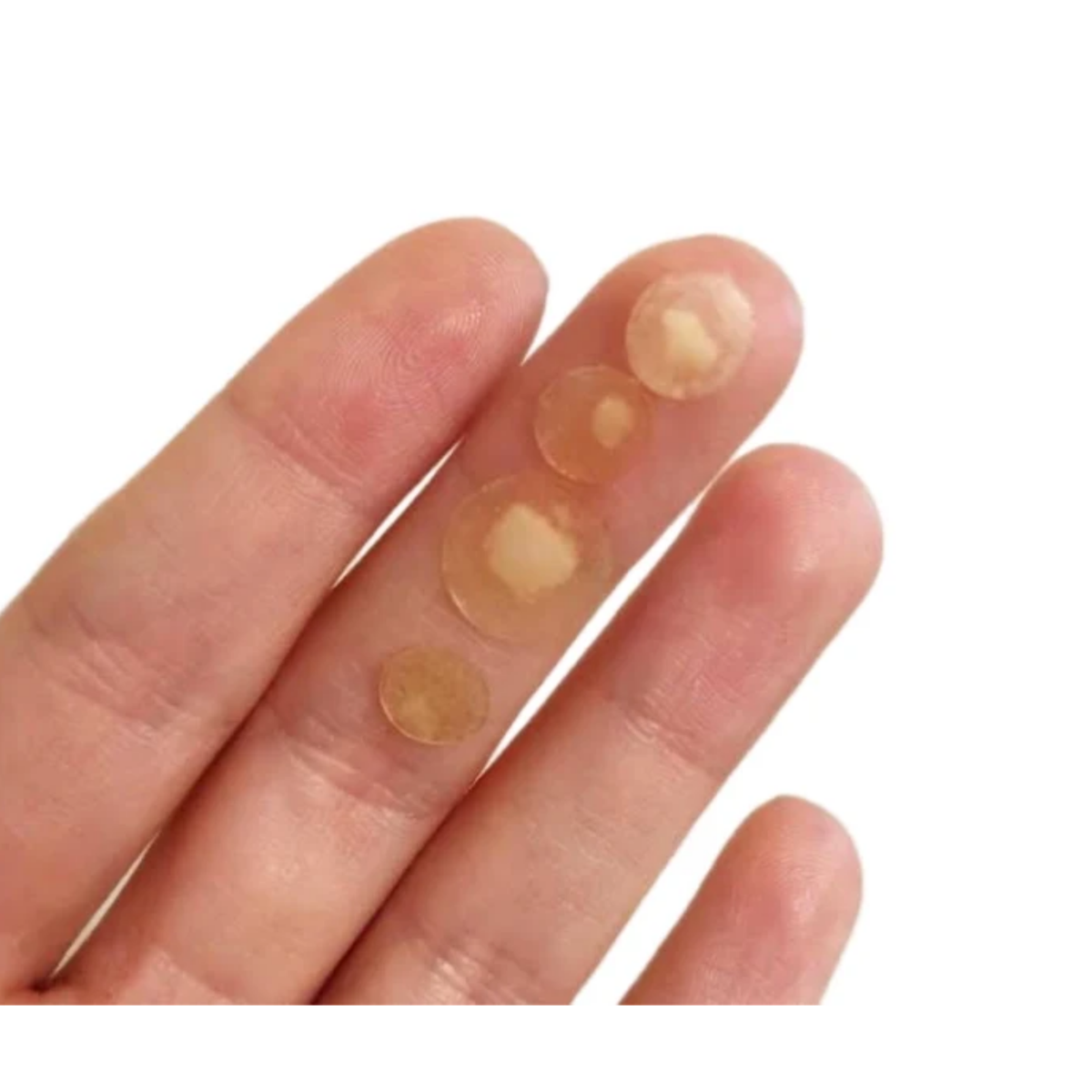 Skin Deep Miracle Patch