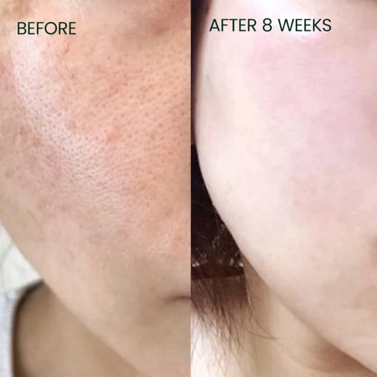 Skin Deep Vit C Burst Antioxidant Face Serum