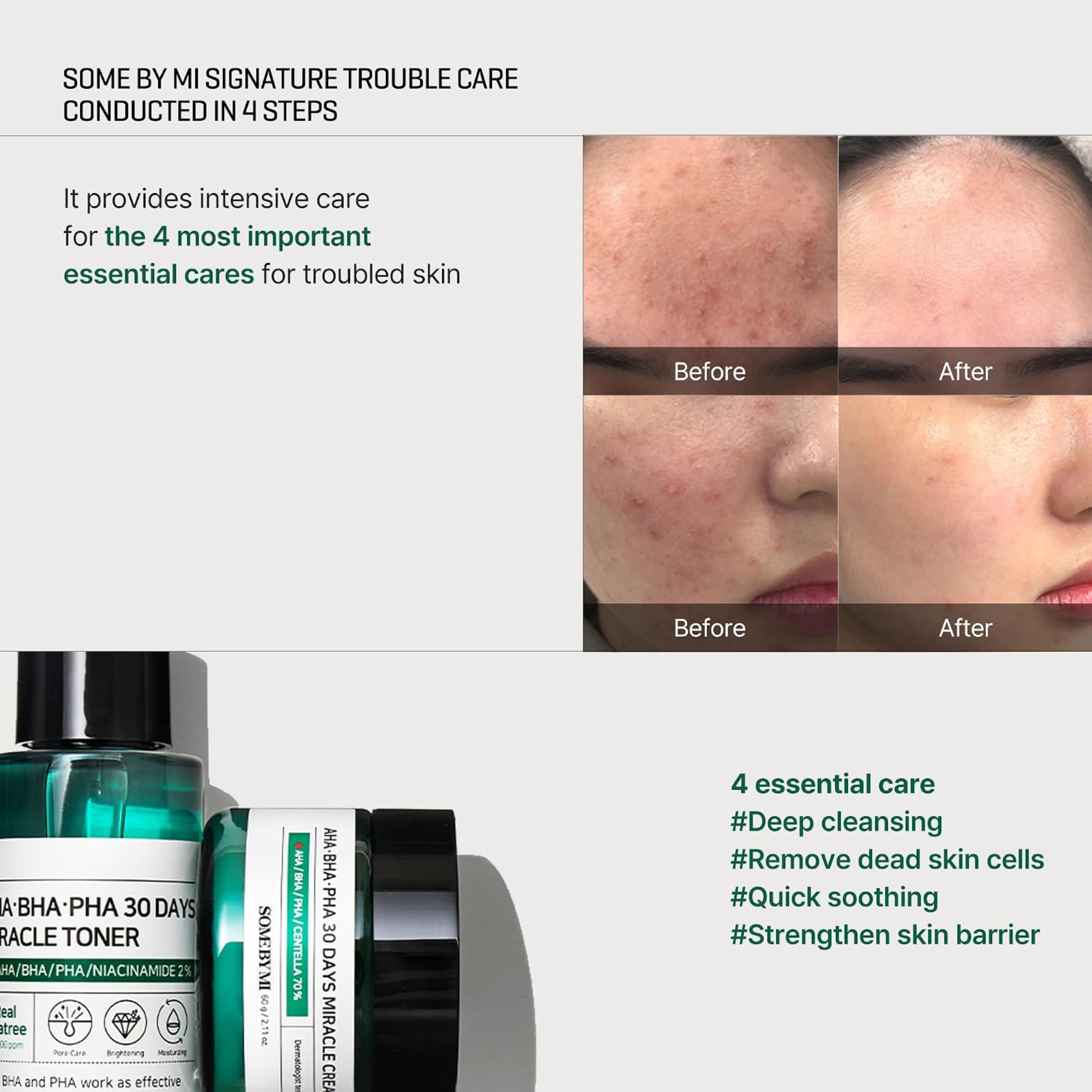 Some By Mi AHA BHA PHA 30 Days Miracle Starter Kit