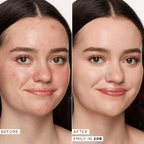 Tarte Shape Tape Radiant Concealer 20B Light 10ml