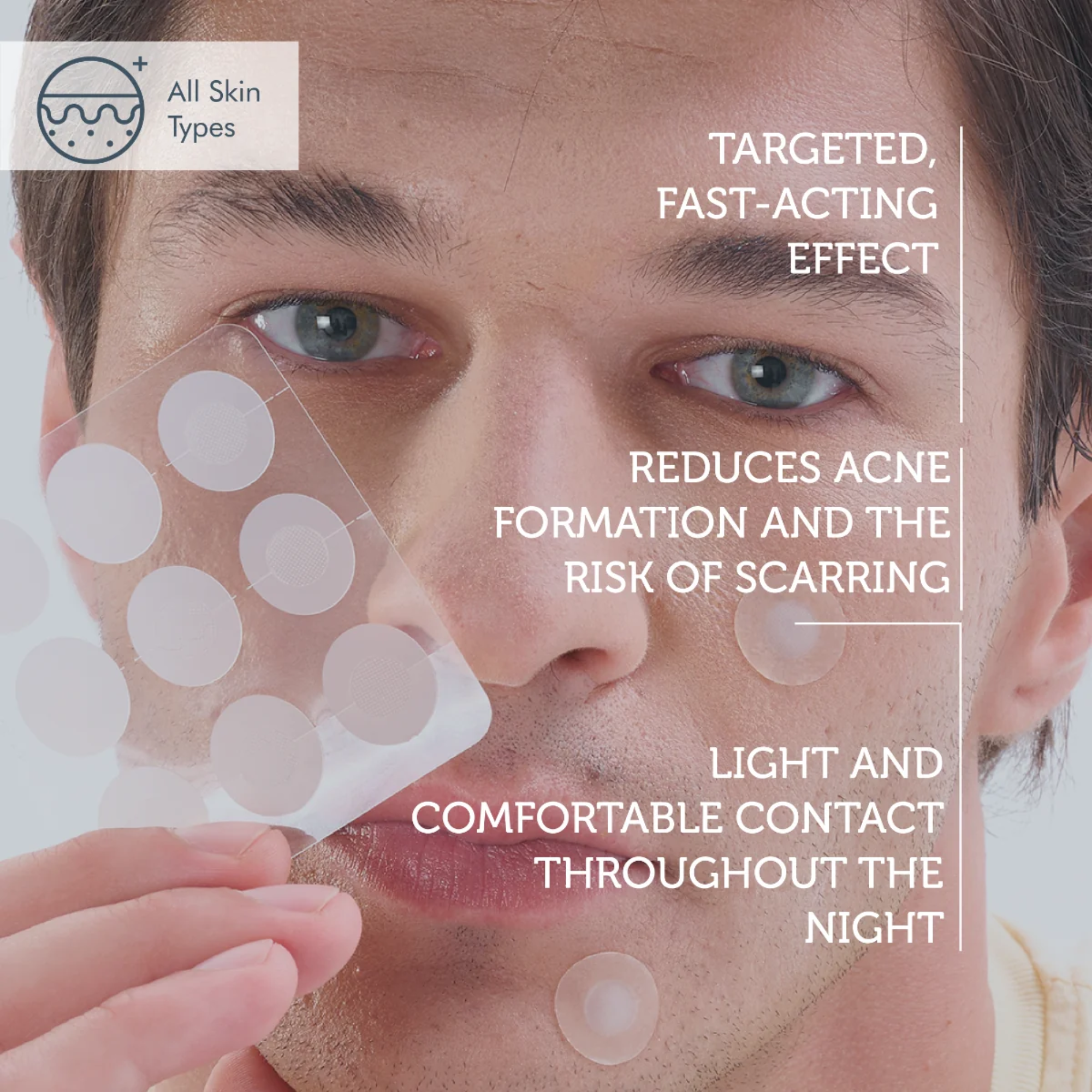 The Purest Solutions Microneedle Acne Patches