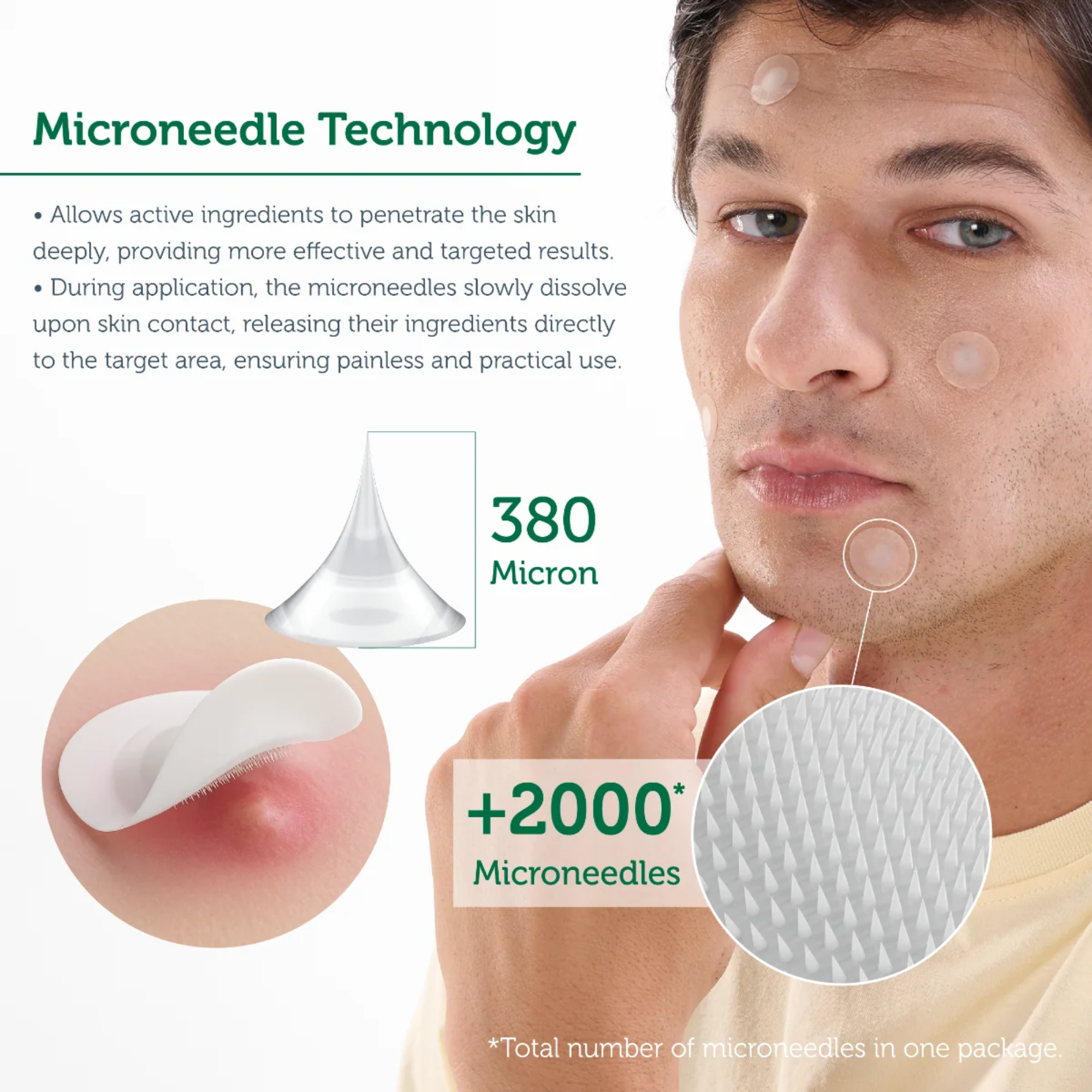 The Purest Solutions Microneedle Acne Patches