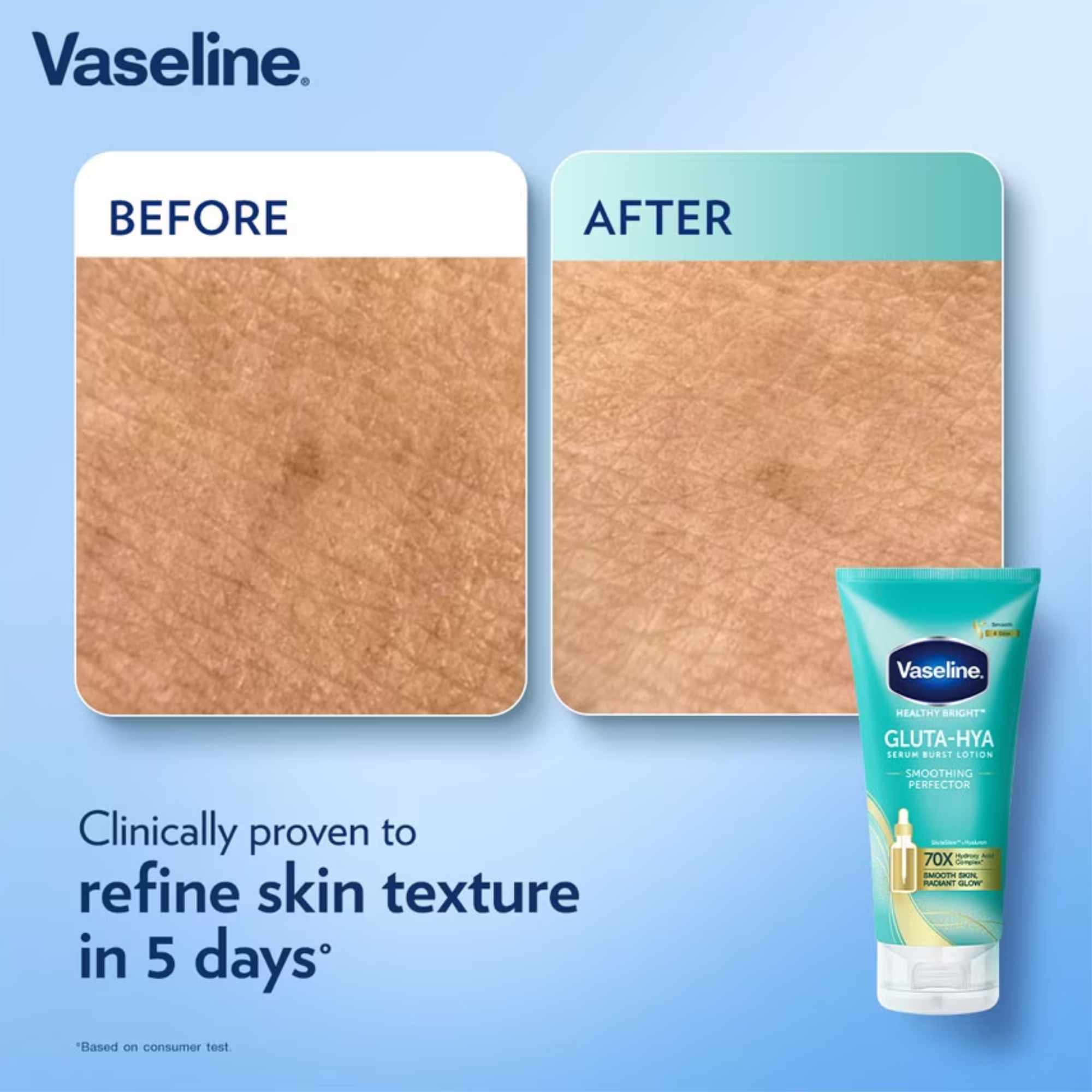 Vaseline Healthy Bright Gluta-Hya Serum Burst Lotion Smoothing Perfector 300ml Before | After Image