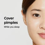 COSRX Acne Pimple Master Patch 24 Patches