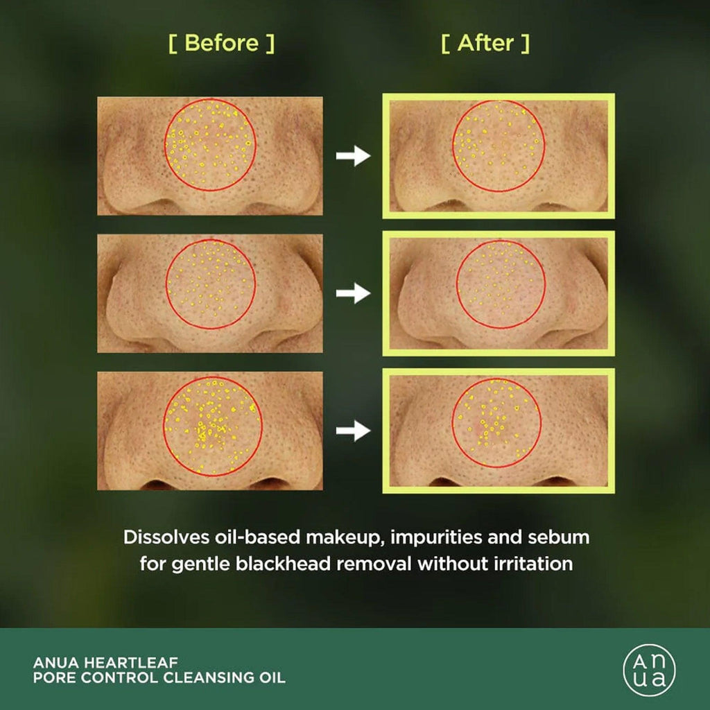 Anua Heartleaf Pore Control Cleansing Oil 20ml - TheSkinFit