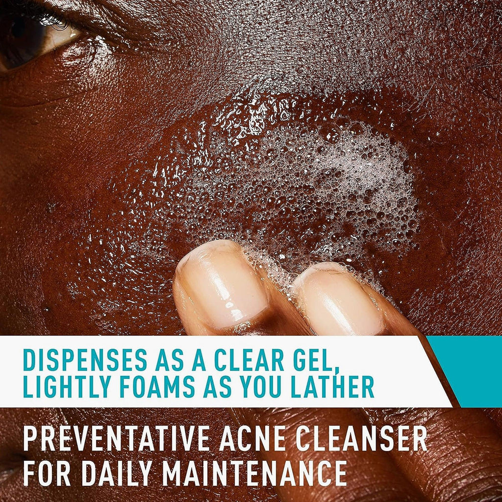 CeraVe Acne Control Cleanser 2% Salicylic Acid Acne Treatment 237ml - TheSkinFit