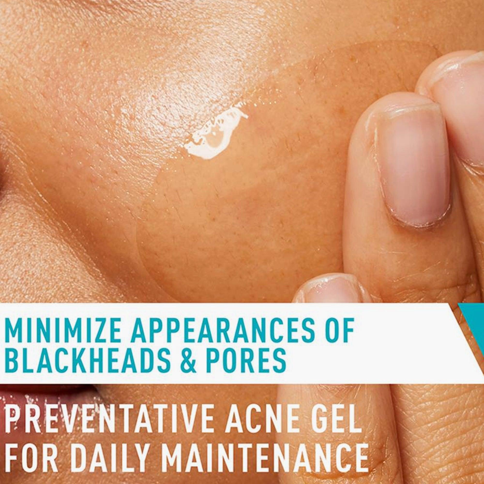 CeraVe Acne Control Gel 40ml - TheSkinFit