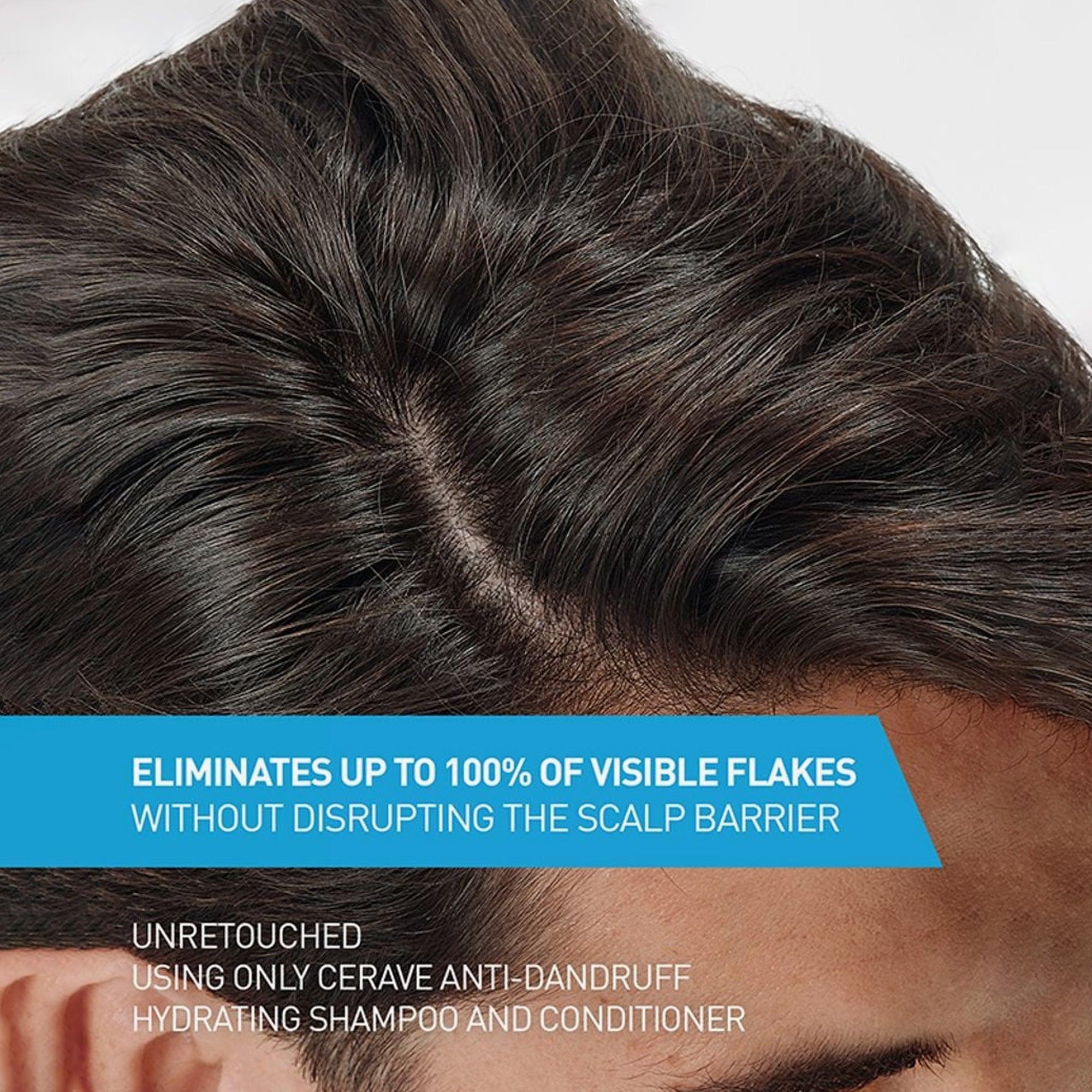 CeraVe Anti-Dandruff Hydrating Shampoo 355ml - TheSkinFit