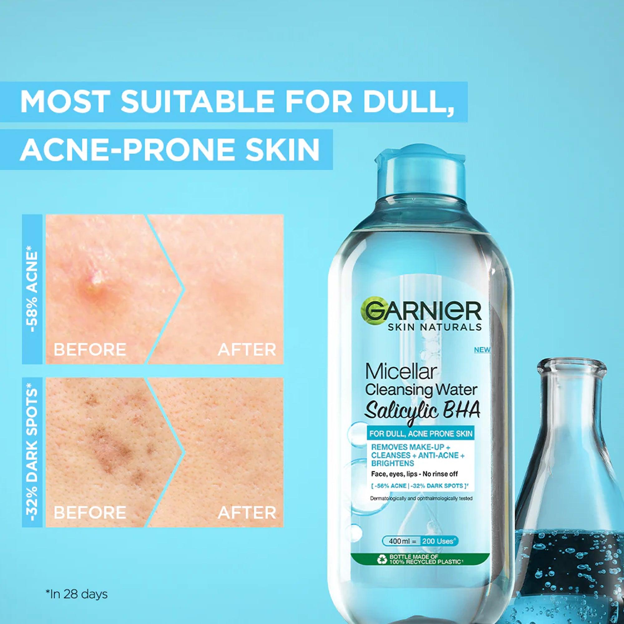 Garnier Skin Naturals Micellar Cleansing Water Salicylic BHA 125ml - TheSkinFit