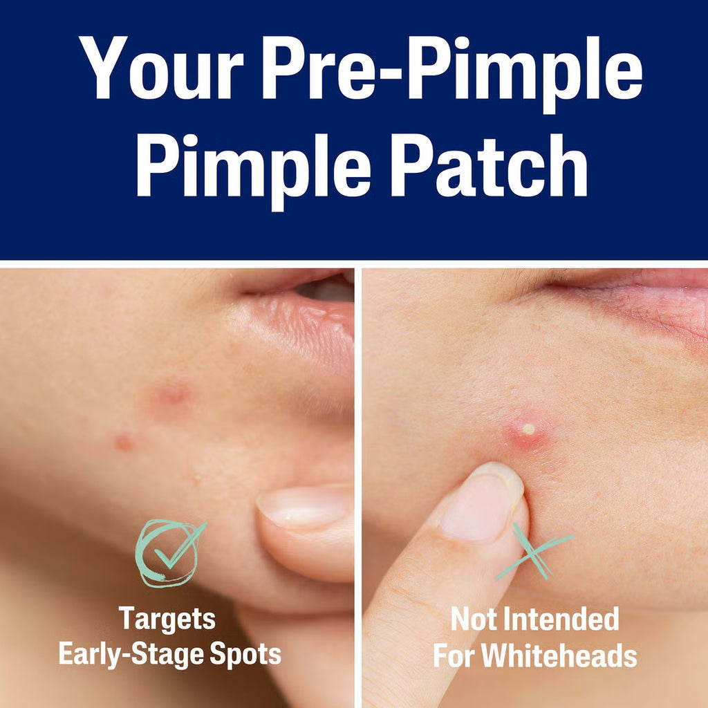Pure O Fresh Pimple Patch 36 Patches