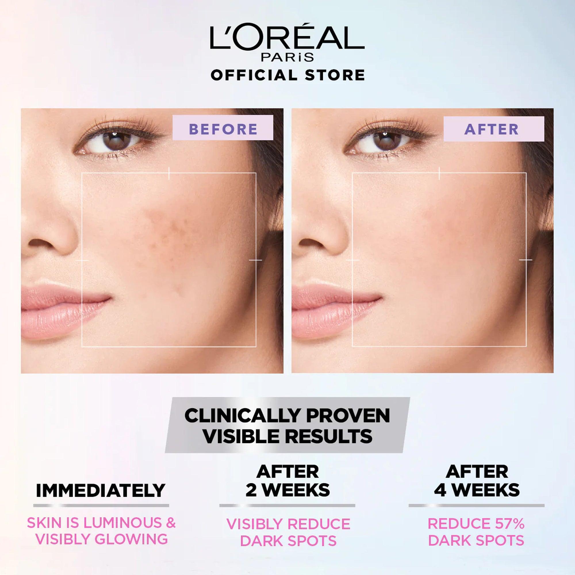 L'Oreal Paris Glycolic-Bright Instant Glowing Serum Mask - TheSkinFit