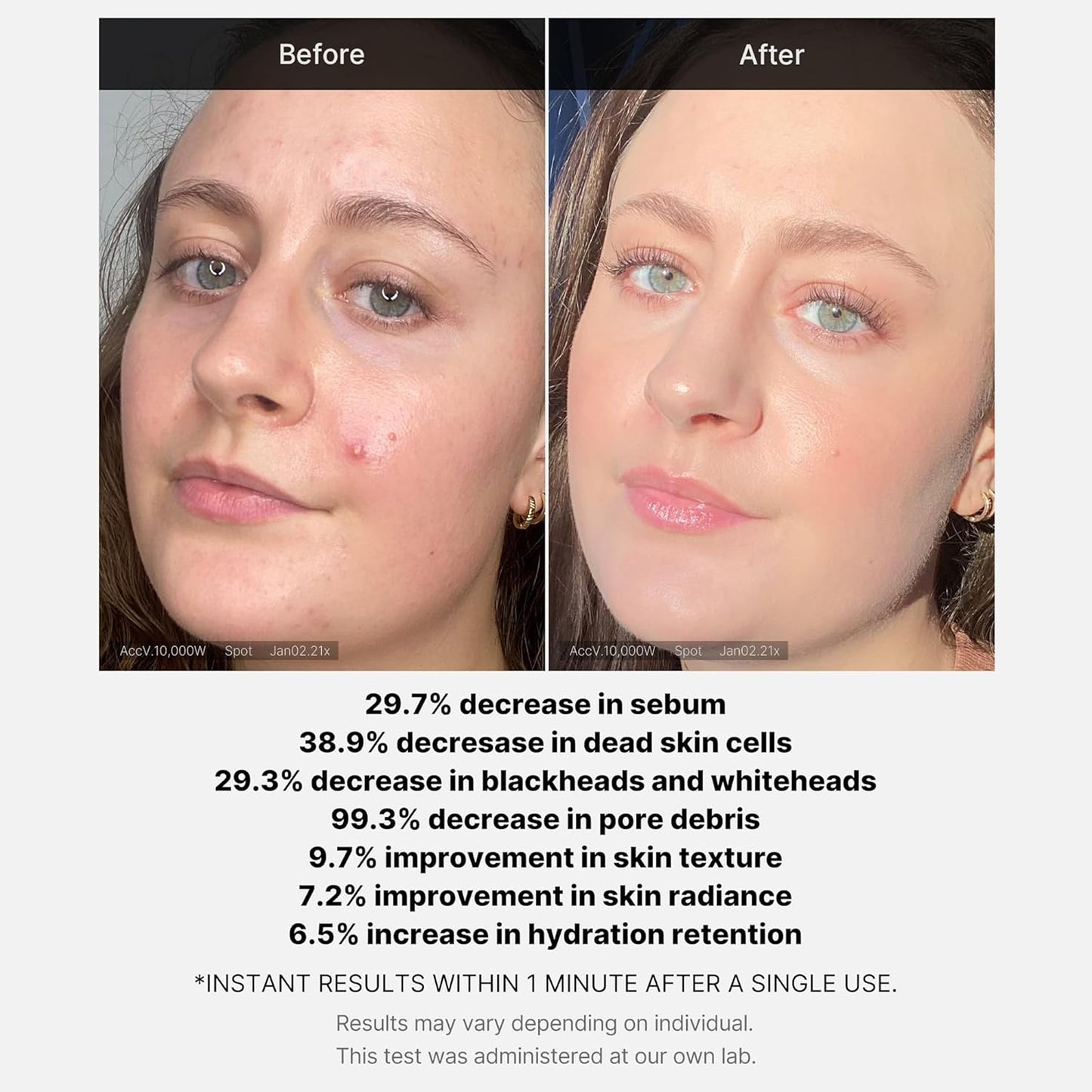 Medicube 1 Min Red Acne Succinic Acid Peel 40gm