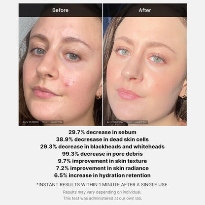 Medicube 1 Min Red Acne Succinic Acid Peel 40gm