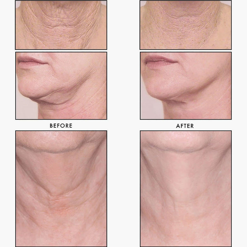 Revision Skincare Nectifirm Advanced 48gm - TheSkinFit