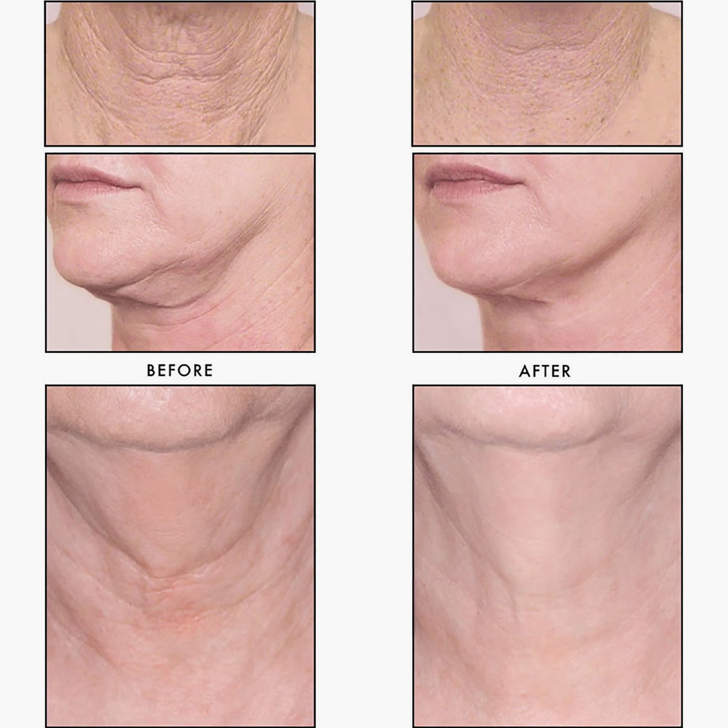 Revision Skincare Nectifirm Advanced 48gm