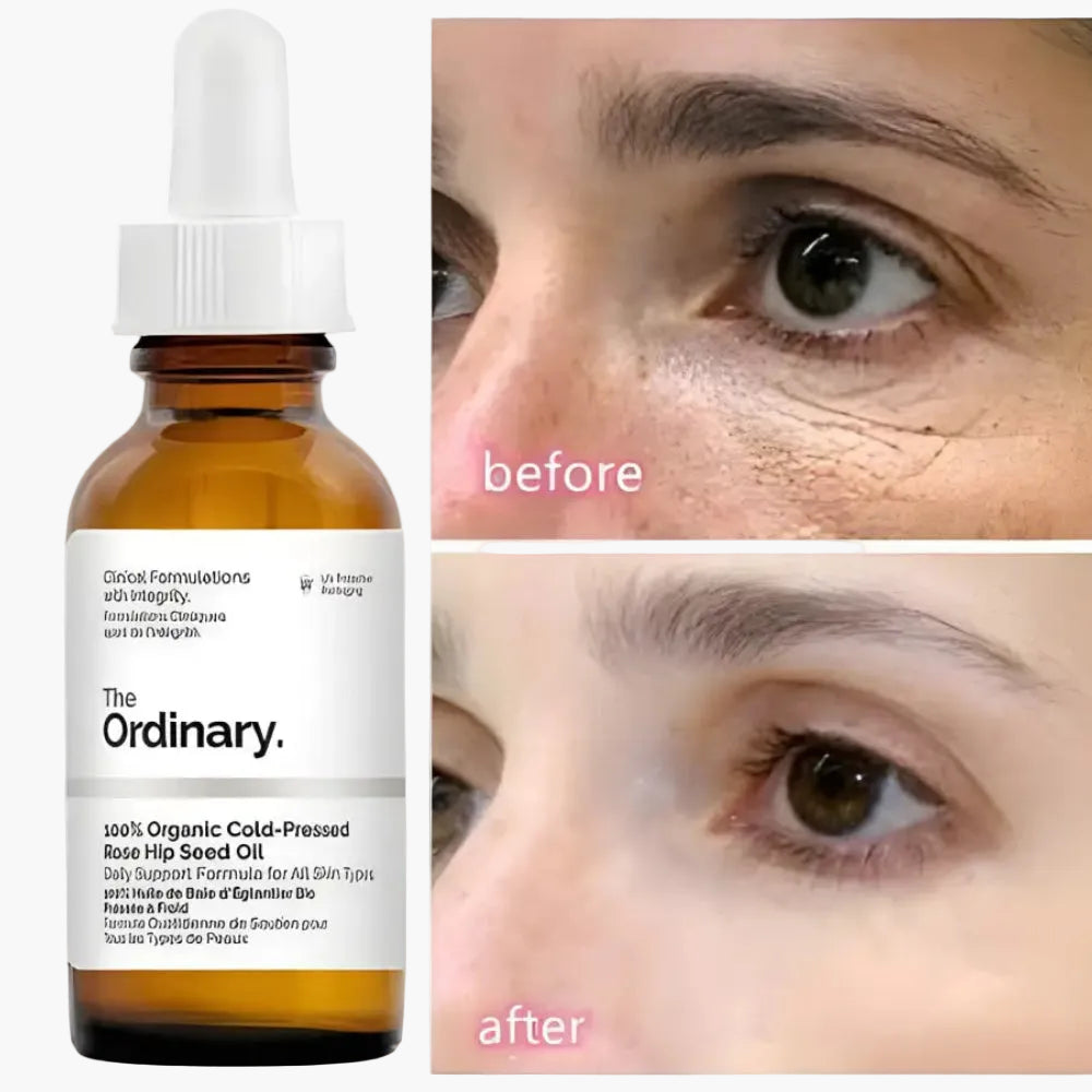 the ordinary 100 organic cold-pressed rose hip seed oil ingredients The Ordinary 100% Organic Cold-Pressed Rose Hip Seed Oil 30ml