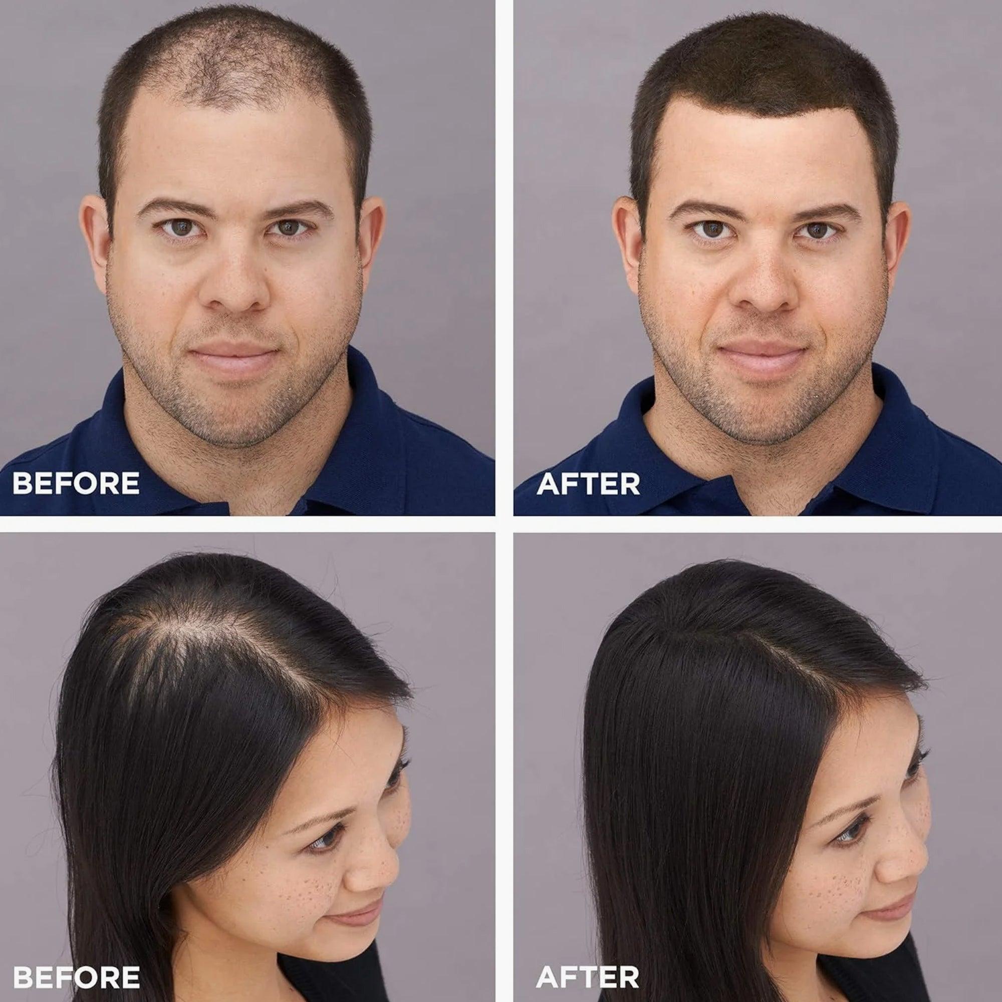 Toppik Hair Building Fibers Black 12gm - TheSkinFit